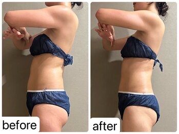 メロウ(me: llow)/ブライダルエステ/痩身エステ