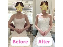 ボディキュア ブライダル美容整体 大阪梅田/肩の高さが揃います♪/大阪/梅田