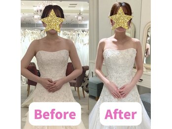 ボディキュア ブライダル美容整体 大阪梅田/肩の高さが揃います♪/大阪/梅田