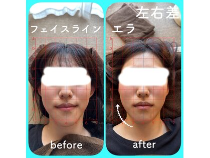 トーラス 整体(TORUS)の写真