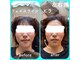 トーラス 整体(TORUS)の写真
