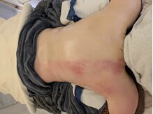 ココル(cocoru)の雰囲気（筋膜リリースしながら、硬くなったお肉を柔らかくしシェイプUP！）