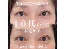 エタニティー(eternity)