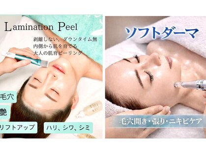 ヨノ(Yono)の写真