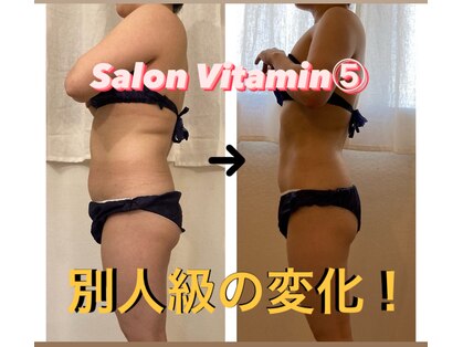サロン ビタミンファイブ(Salon Vitamin5)の写真