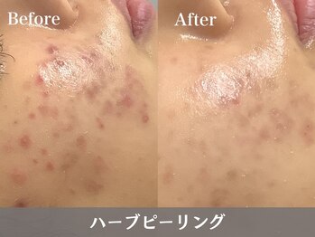 トウメイコガオ 横浜店/トウメイコガオでハーブ