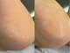 ブルジョン 横浜元町(Bourgeon)の写真/《韓国発☆エスプランニング導入サロン》最新の技術でガサガサ角質をケア◎しっとりすべすべの足裏に＊