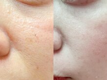 ハレオラ(HaleOla)/オーナー自身の変化★7回目