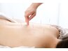 〇鍼人気No2〇睡眠　耳鳴り　めまいの早期改善に　鍼+ほぐし　¥6500→¥3980