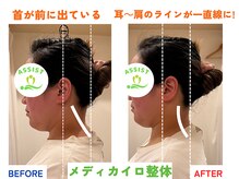 四条大宮アシスト鍼灸整骨院/全身整体ビフォーアフター