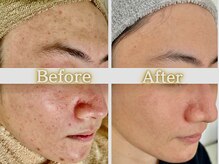 ハル(HARU.)の雰囲気（モテる男の肌管理メンズの肌改善もおまかせ下さい！）