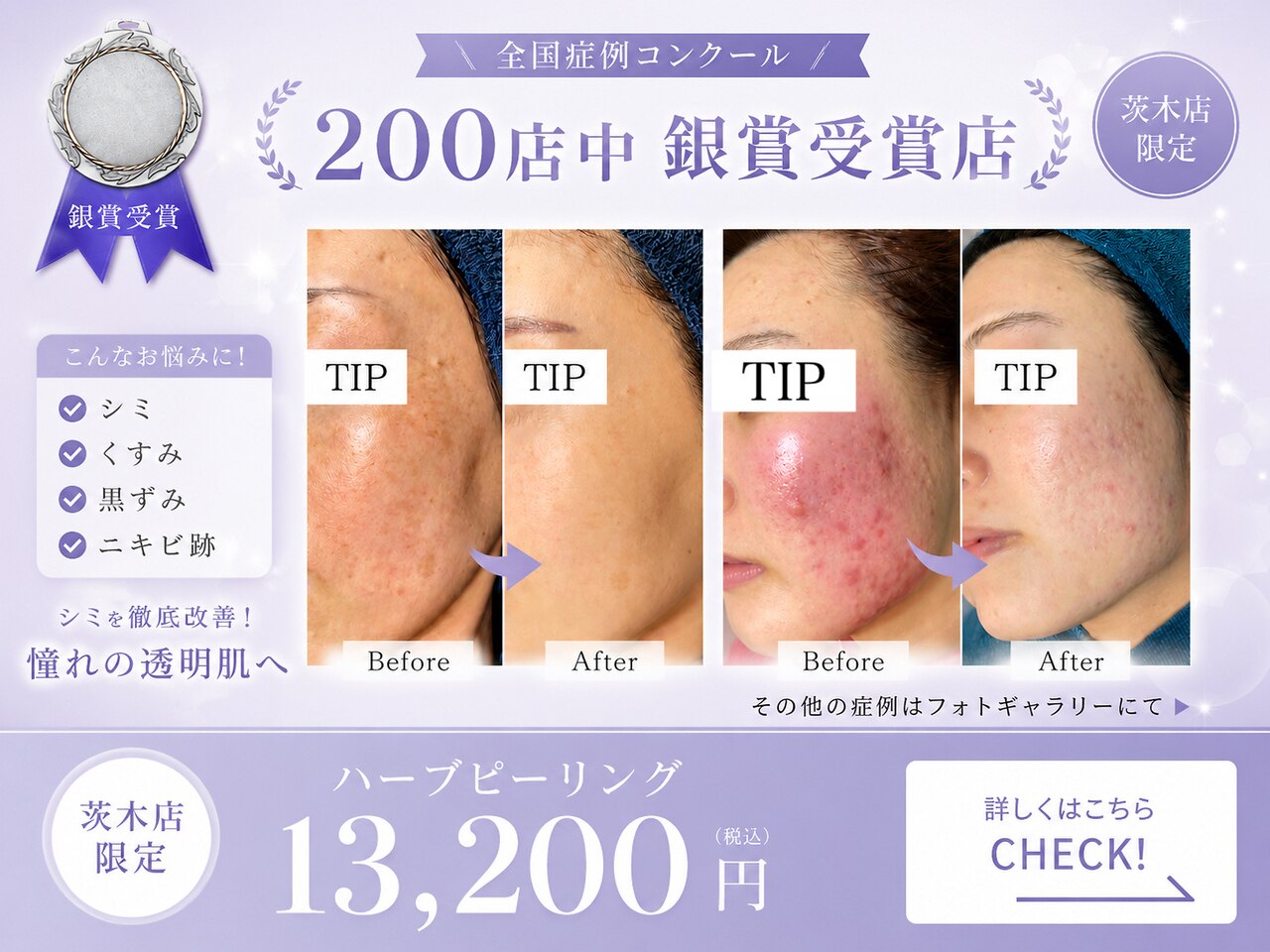 ハービー(Herbee)｜ホットペッパービューティー