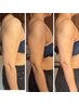 筋膜リリースカッター上半身★二の腕背中集中/肩甲骨はがしで姿勢改善