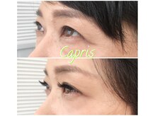ビューティーサロン カプリス(Capris)/40代のお客様ボリュームラッシュ