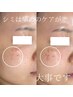 【シミ改善&ツヤ肌】濃い&薄いシミ改善◎シミケア20分当て放題11000→8800