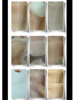 ビューティフィーサロン ベルル(Belulu)/韓国式3D毛穴洗浄／施術の流れ