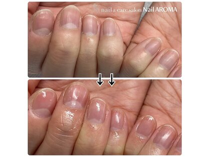 ネイルアロマ(Nail AROMA)の写真