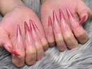 チップスカルプフレンチ