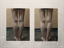 アバンダンティア 姫路店/★キャビテーション★