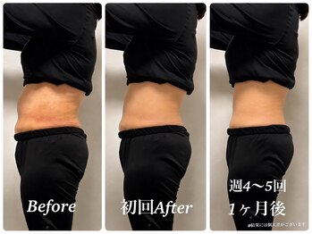 ヨサパーク ルルア(YOSA PARK Lulua)の写真/【痩せない原因に集中アタック！】進化系よもぎ蒸し×深部リンパケアで温活痩身◎理想の美ボディへ