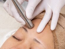 シャルム(Charme)/ダイヤモンドピーリング