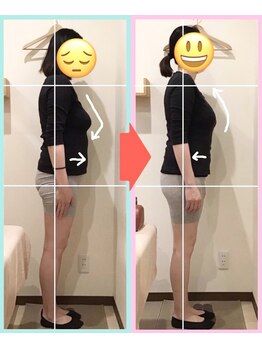 なぎさ整骨院/産後骨盤骨盤矯正10回目