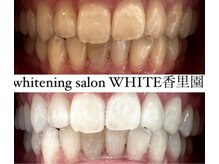 ホワイト 香里園店(WHITE)の雰囲気（ヤニや頑固な黄ばみも輝く白さへ★）