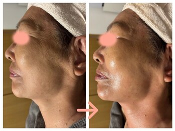 サロン ド ブラン(Salon de Blanc)/50代以降の女性必見