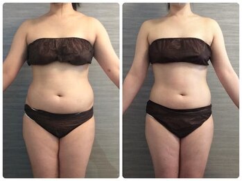 ウェリナ平和堂長久手院/小顔矯正/骨盤矯正/美脚サロン