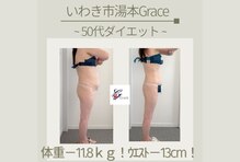 グレース(Grace luxe)