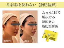 ジ エステティック イーズ サクラマチ熊本店/ビフォーアフター2