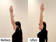 ソレア(Solea)/肩こり改善1回目