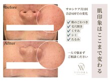 ヴィヴォラ(VIVORA)