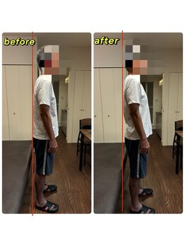 アンティオール 中目黒店/猫背も改善します!☆