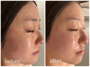 ベル みどりの店(belle)/