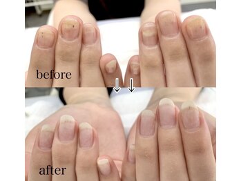 ネイルアロマ(Nail AROMA)