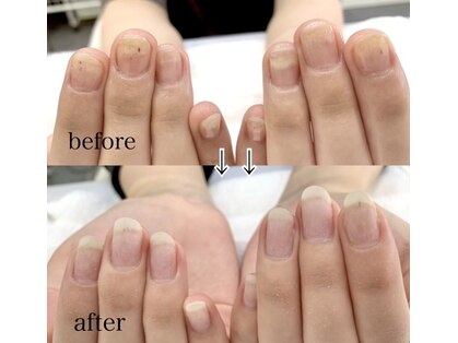 ネイルアロマ(Nail AROMA)の写真