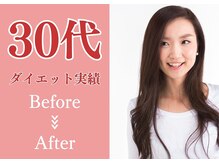 心身堂整体院 草津院/30代のダイエット実績[小顔矯正]
