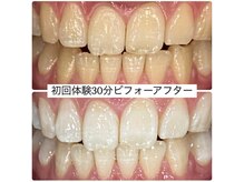 ホワイトニングルーム 川崎店(WhiteningRoom)/ホワイトニング/川崎