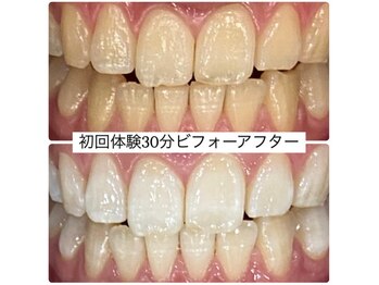 ホワイトニングルーム 川崎店(WhiteningRoom)/ホワイトニング/川崎