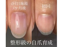 育成に特化した技術で健康な美爪へ…最短3ヶ月で結果を出します