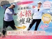 ヨサパーク ヴィラ デ ミューズ(yosa park villa des Muses)