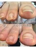 【もう自分では悩まない】肥厚爪・軽度の巻爪も快適美爪ケア（70分）
