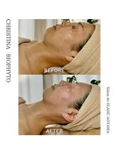 サロン ド ブラン アオヤマ(Salon de BLANC AOYAMA)/BIOPHYTO×韓国美容機器ソノケア