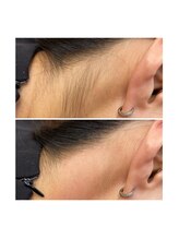 ホワイトワックス 京都四条烏丸(WHITE WAX)/《うなじ》スッキリ◎