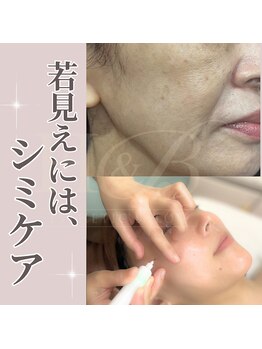 エステティック エイチアンドビー 大和店(H&B)/シミケア　フェイシャル