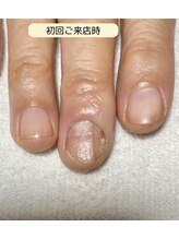 ルームイチマルイチネイルズ(Room101Nails.)/自爪育成・最強のネイルケア鳥取