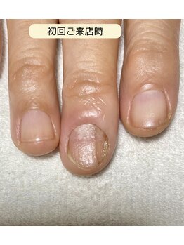 ルームイチマルイチネイルズ(Room101Nails.)/自爪育成・最強のネイルケア鳥取