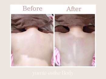 トータルビューティー ゆみえエステ(Total Beauty)/痩身/ボディ/筋膜リリースリンパ