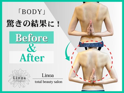 リノア(Linoa)の写真